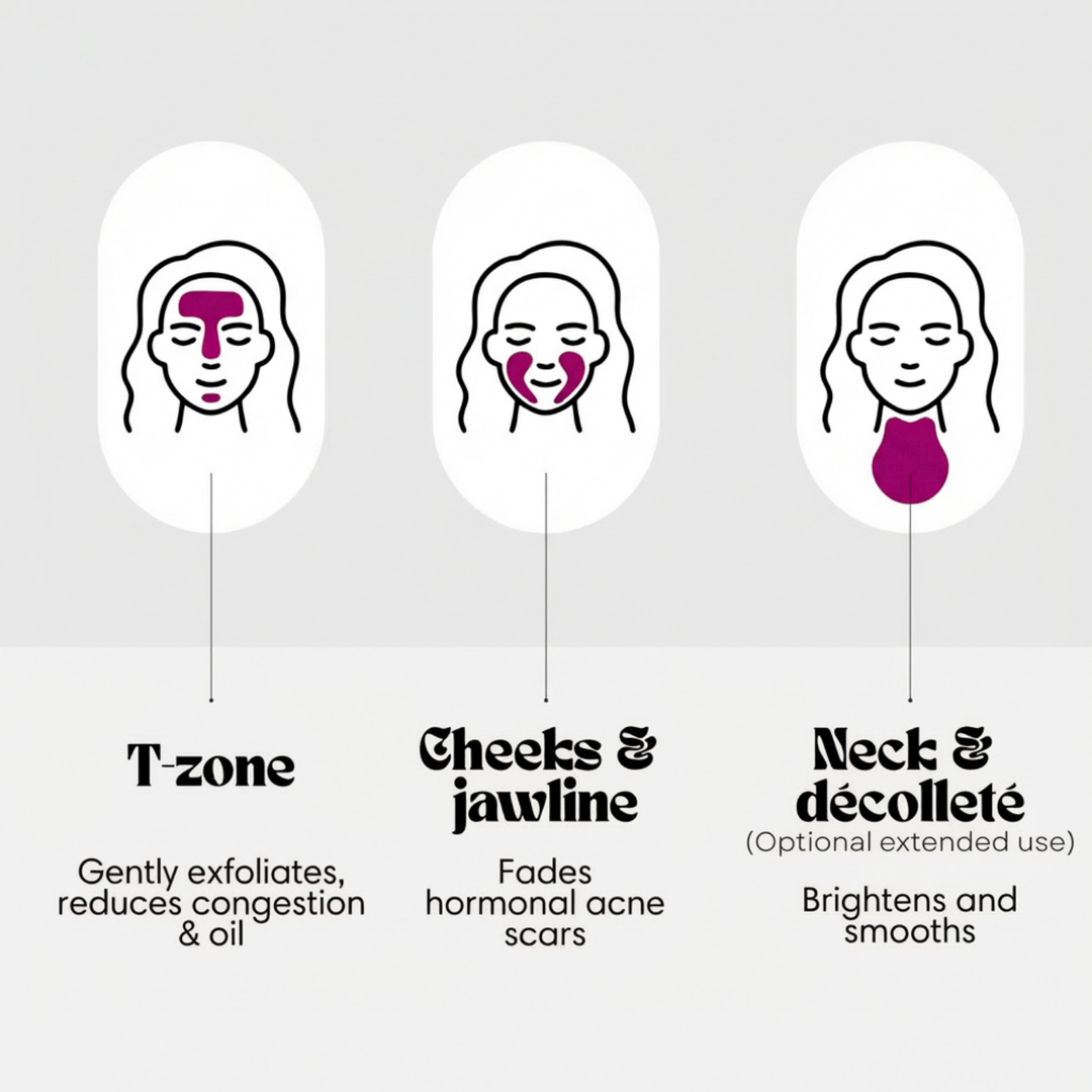 SEORA™ Alpha Arbutin + TXA Cream - Arbutin 7% + Tranexamic Acid 4% Cream