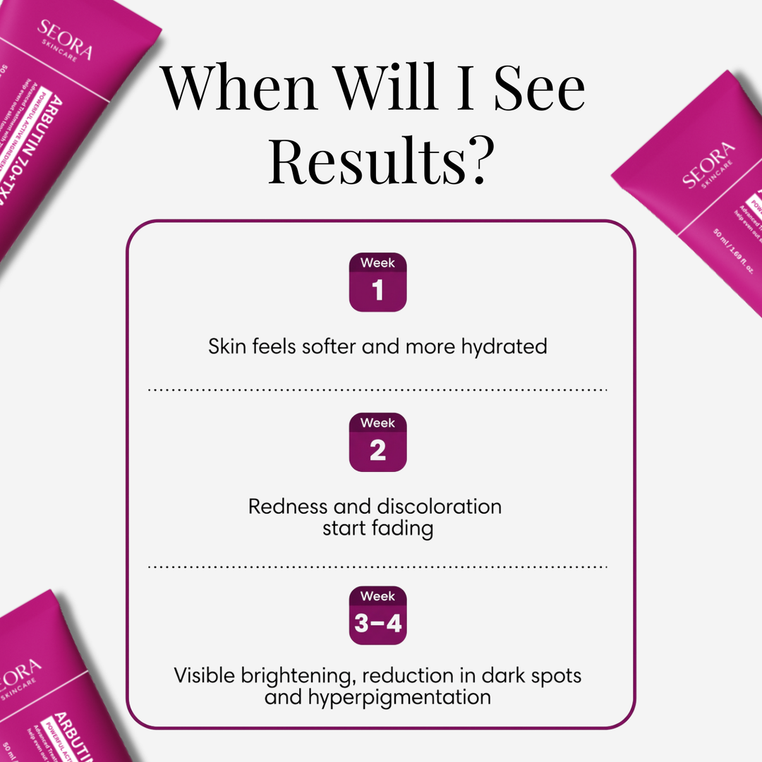 SEORA™ Alpha Arbutin + TXA Cream - Arbutin 7% + Tranexamic Acid 4% Cream