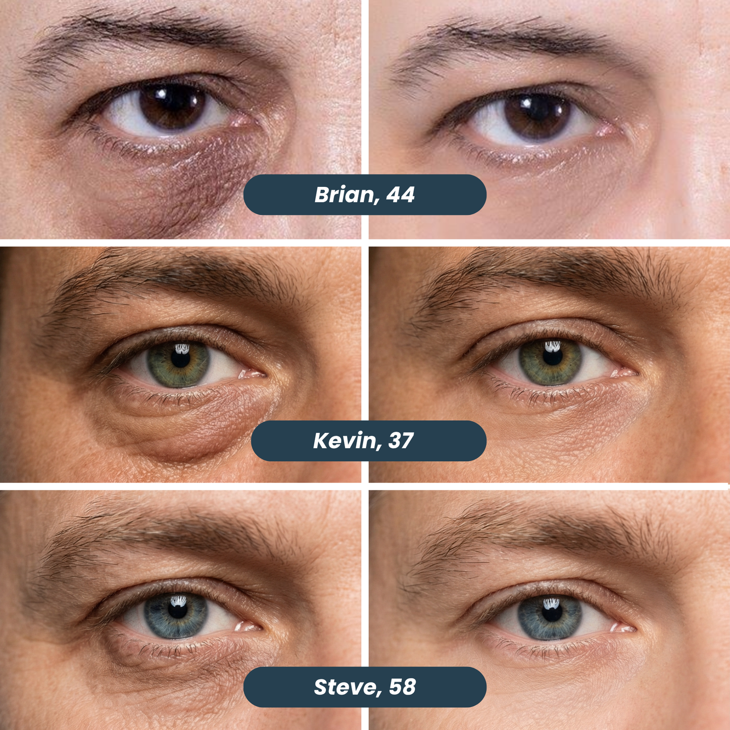 Zenverra Anti-Dark Circles Microneedle Patches