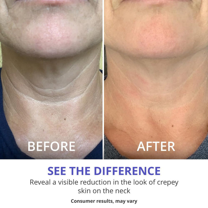 Gopure Tighten & Lift Neck Cream
