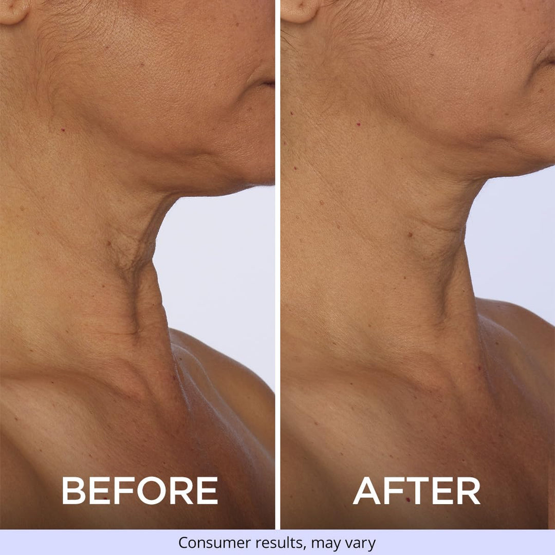 Gopure Tighten & Lift Neck Cream