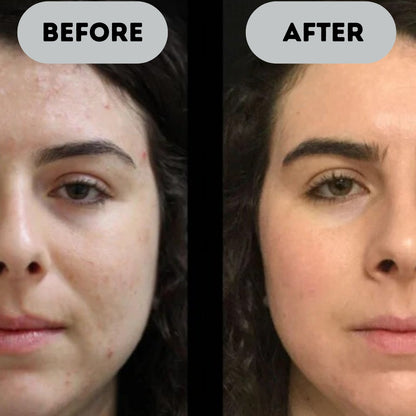 GlowSync™ 7-Colour Skin Renewal Tool