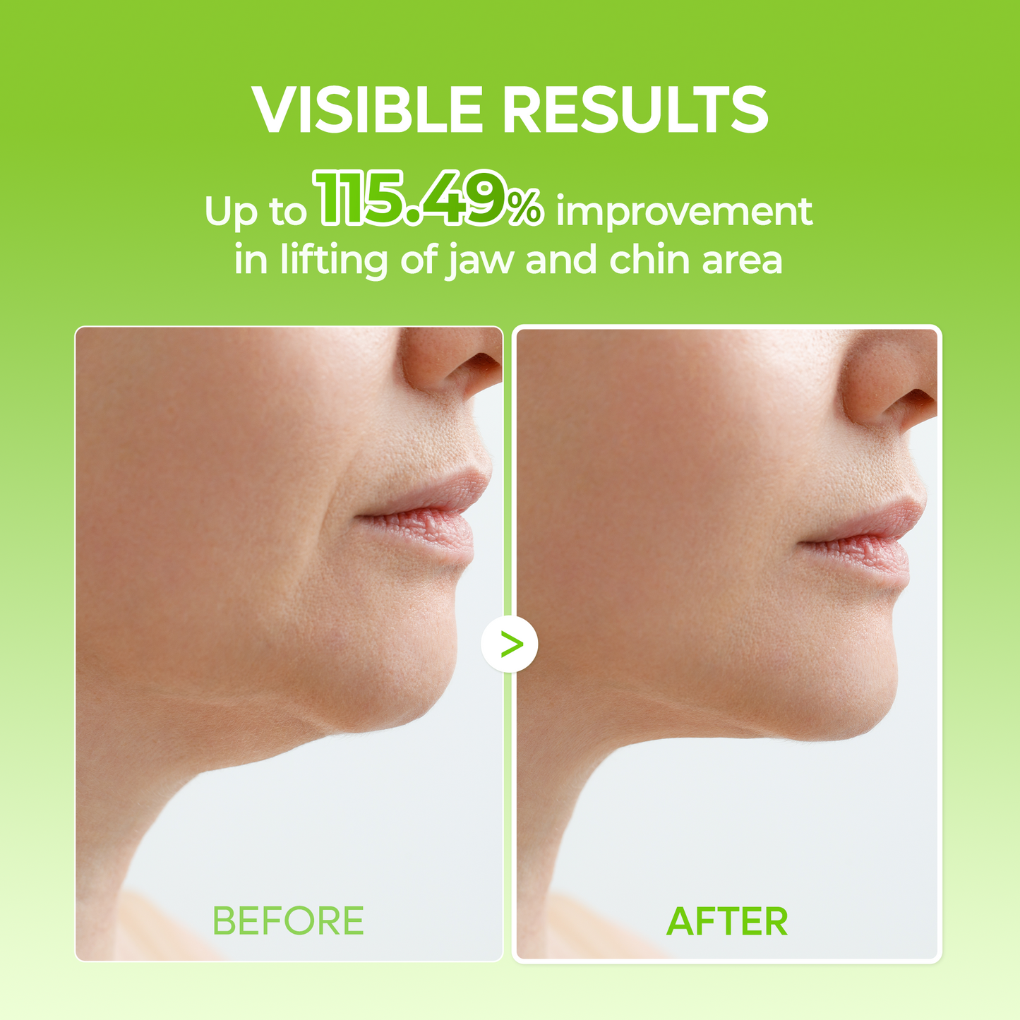 CACTOX V-Lifting Mewing Band 4EA - (4 Masks Included)