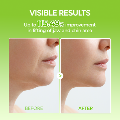 CACTOX V-Lifting Mewing Band 4EA - (4 Masks Included)