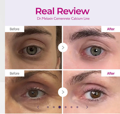 Dr.Melaxin Cemenrete Calcium Dark Spot Eye Cream
