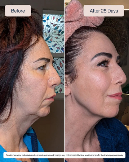 SkinRevive™  Facial Contouring Device