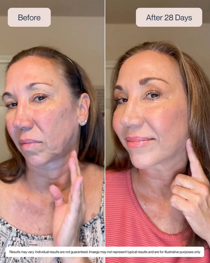 SkinRevive™  Facial Contouring Device