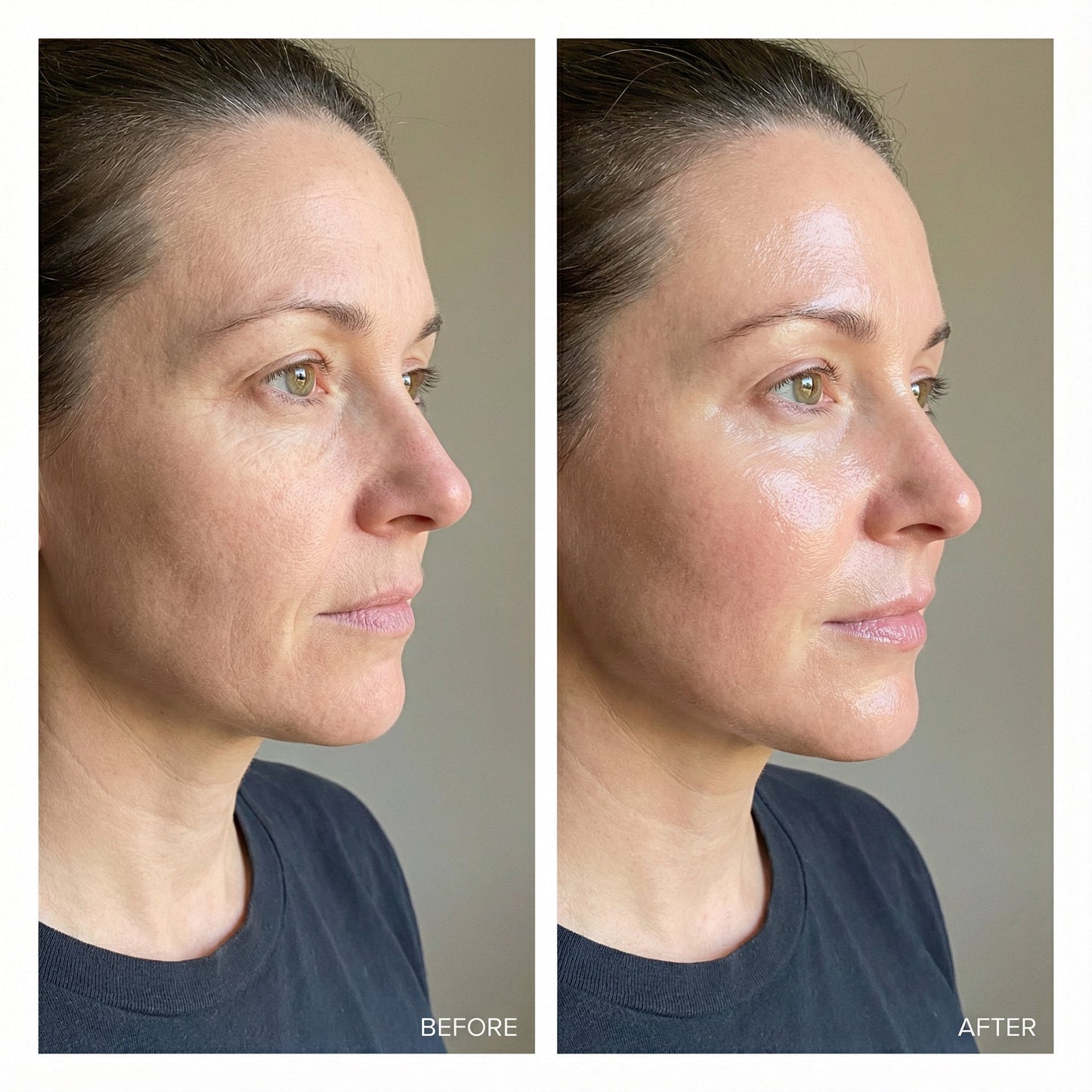 RadiancePro™ LED Photon Therapy Face Mask