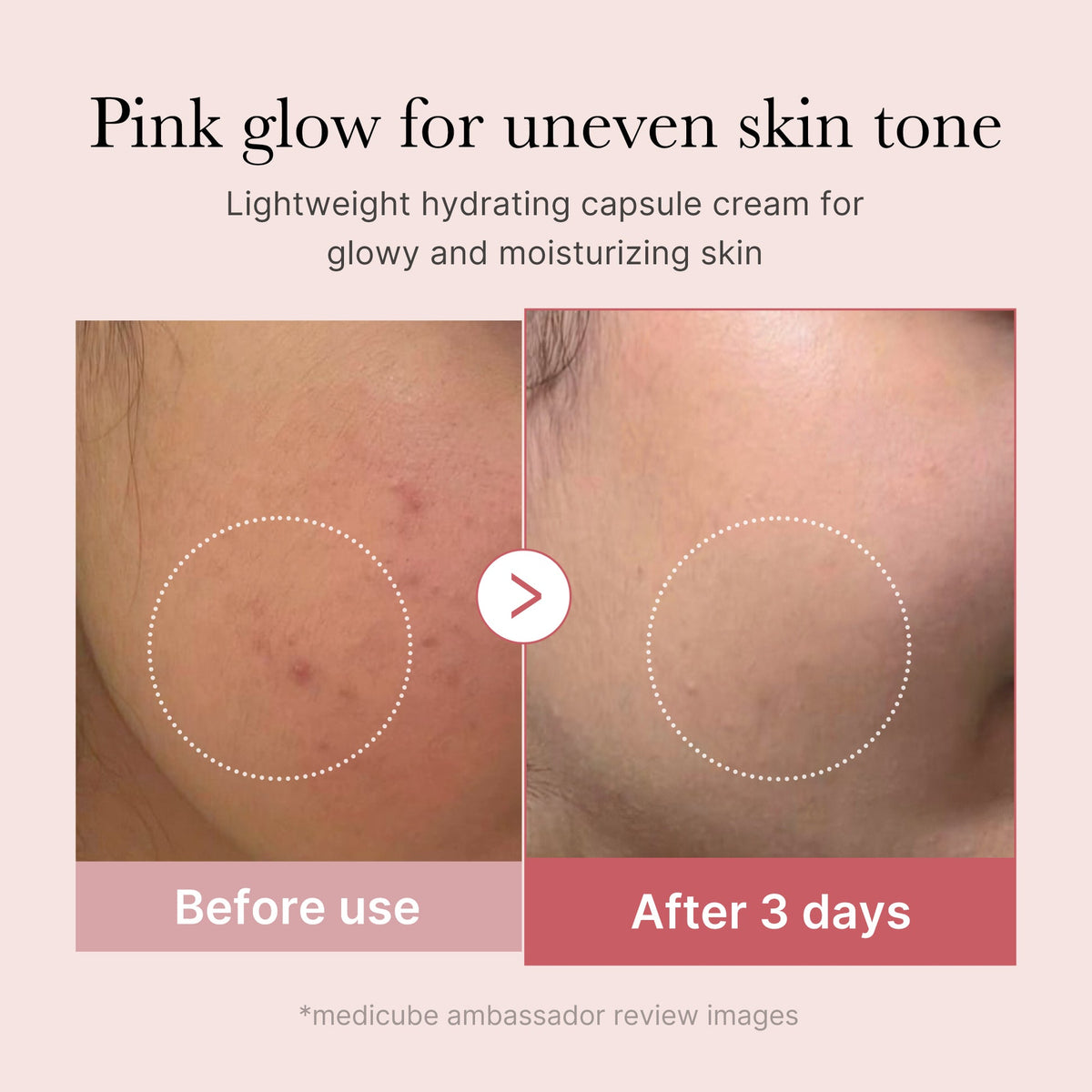 PDRN Pink Collagen Capsule Cream – Salmon DNA, Niacinamide & Hyaluronic Acid Face Moisturizer