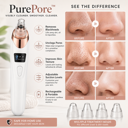 PurePore™ Deep Clean Blackhead Remover