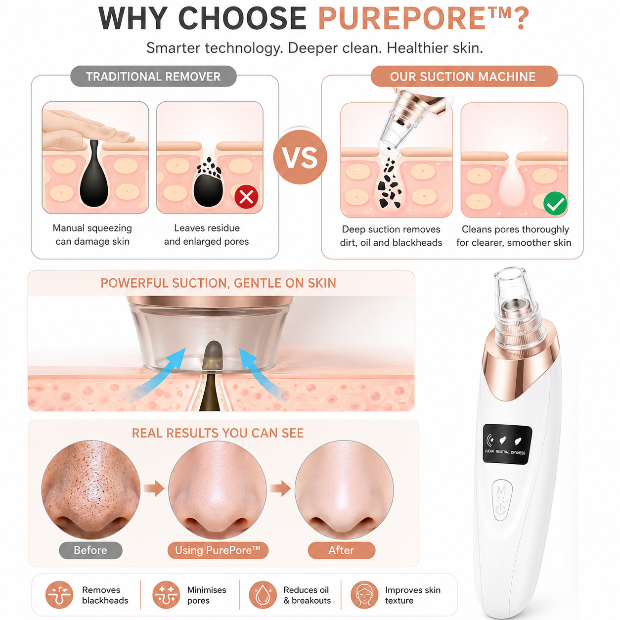 PurePore™ Deep Clean Blackhead Remover