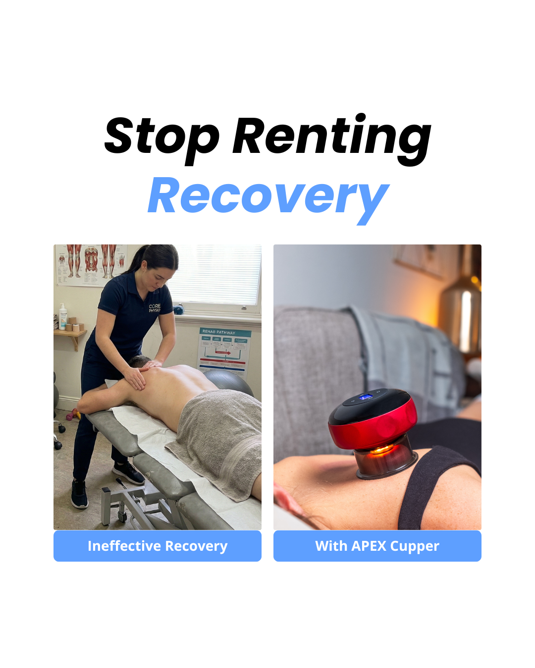 ThermaLift™ Recovery Cupping Device