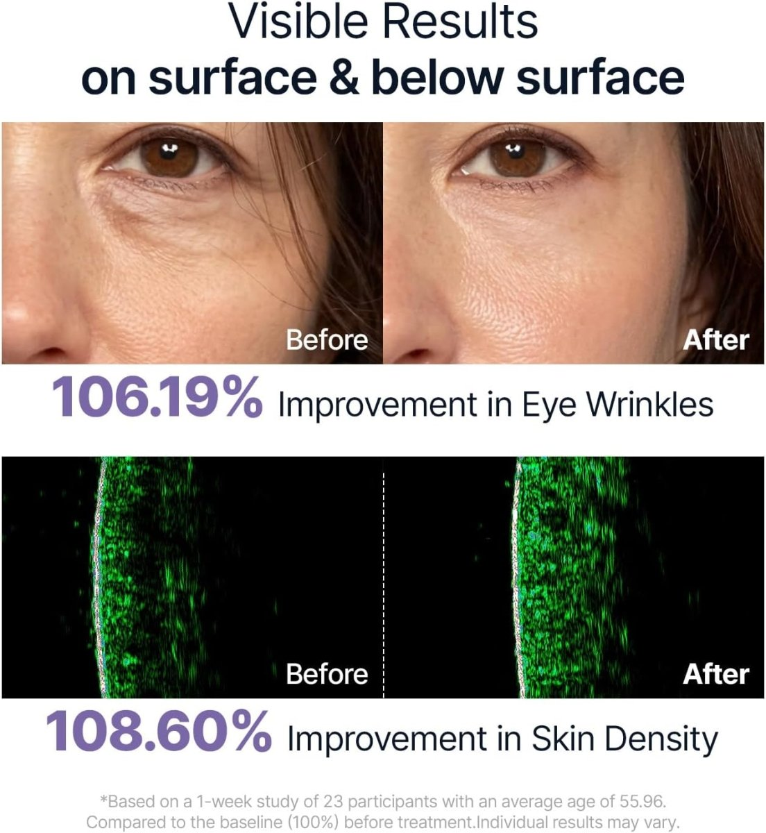 Sungboon Editor™ Deep Collagen Power Boosting Cream in Serum