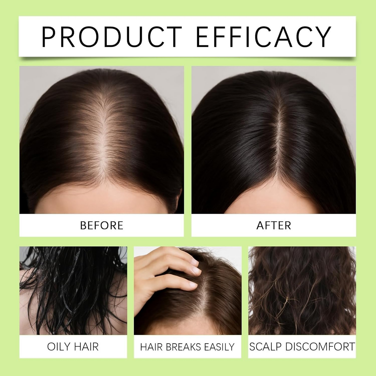 Microneedle Hair Growth Treatment Kit – Scalp Serum for Thinning Hair | Follicore™