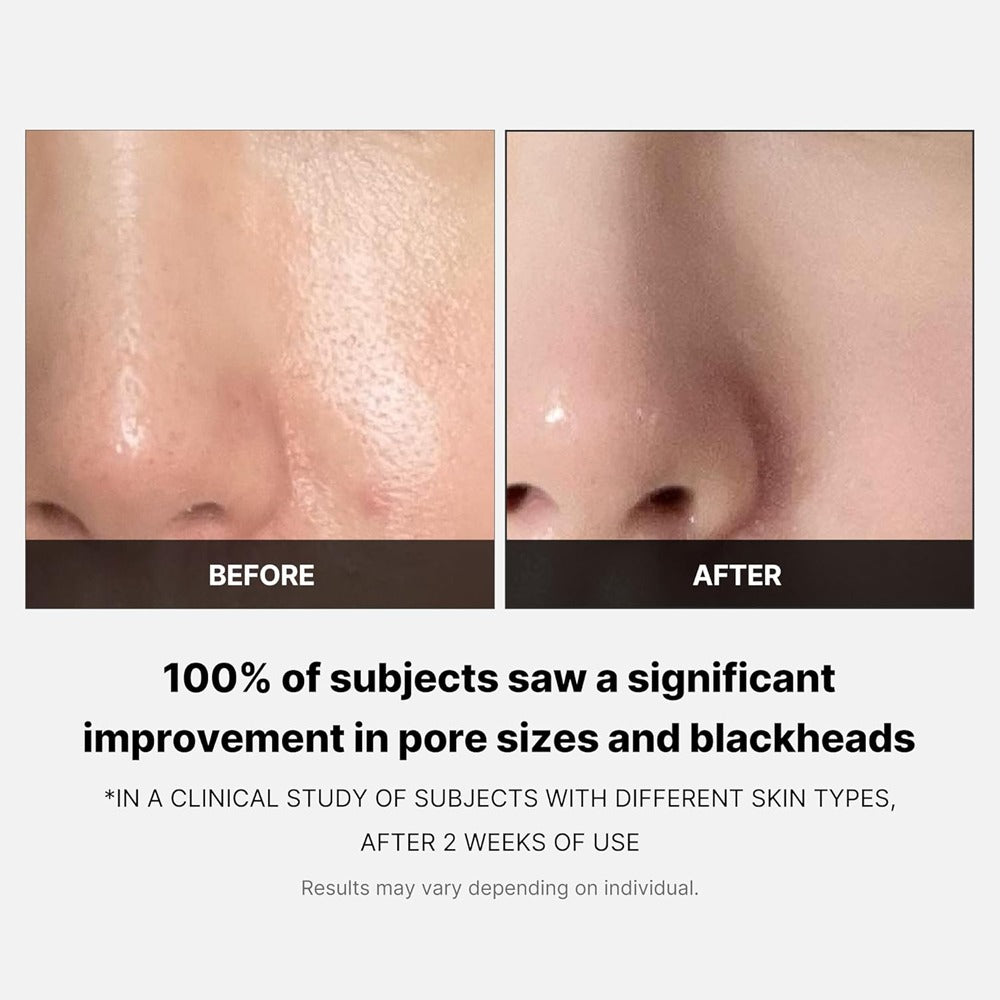Medicube™ Zero Pore Toner Pads