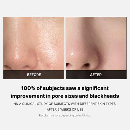 Medicube™ Zero Pore Toner Pads