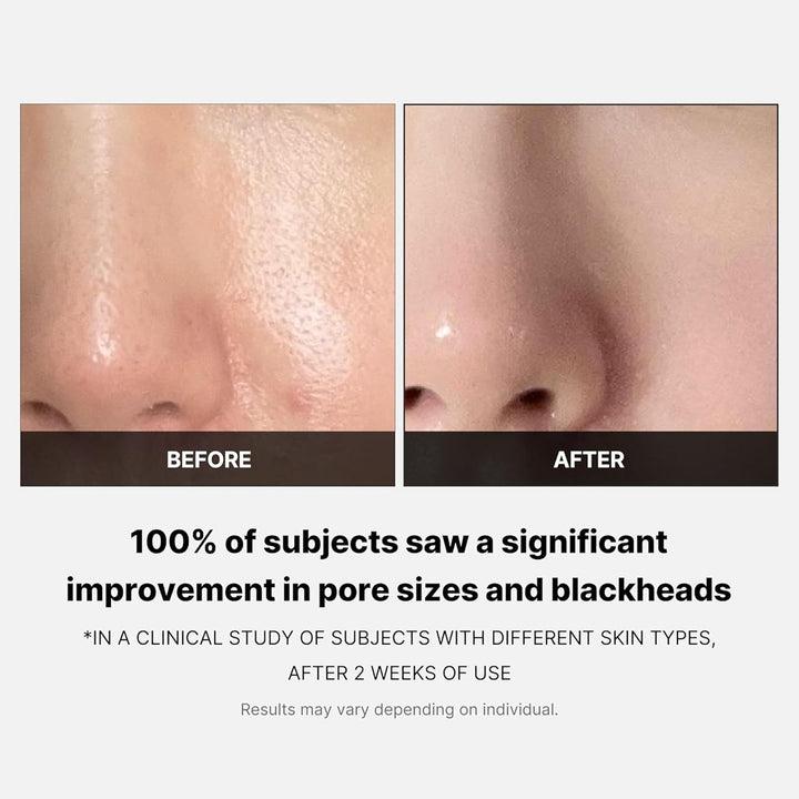 Medicube™ Zero Pore Toner Pads