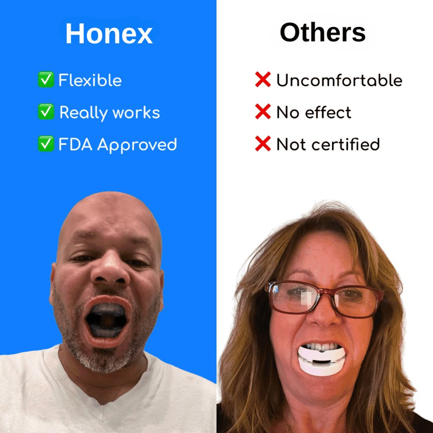 Anti-Snoring Mouthpiece | Adjustable Sleep Guard for Quieter Nights
