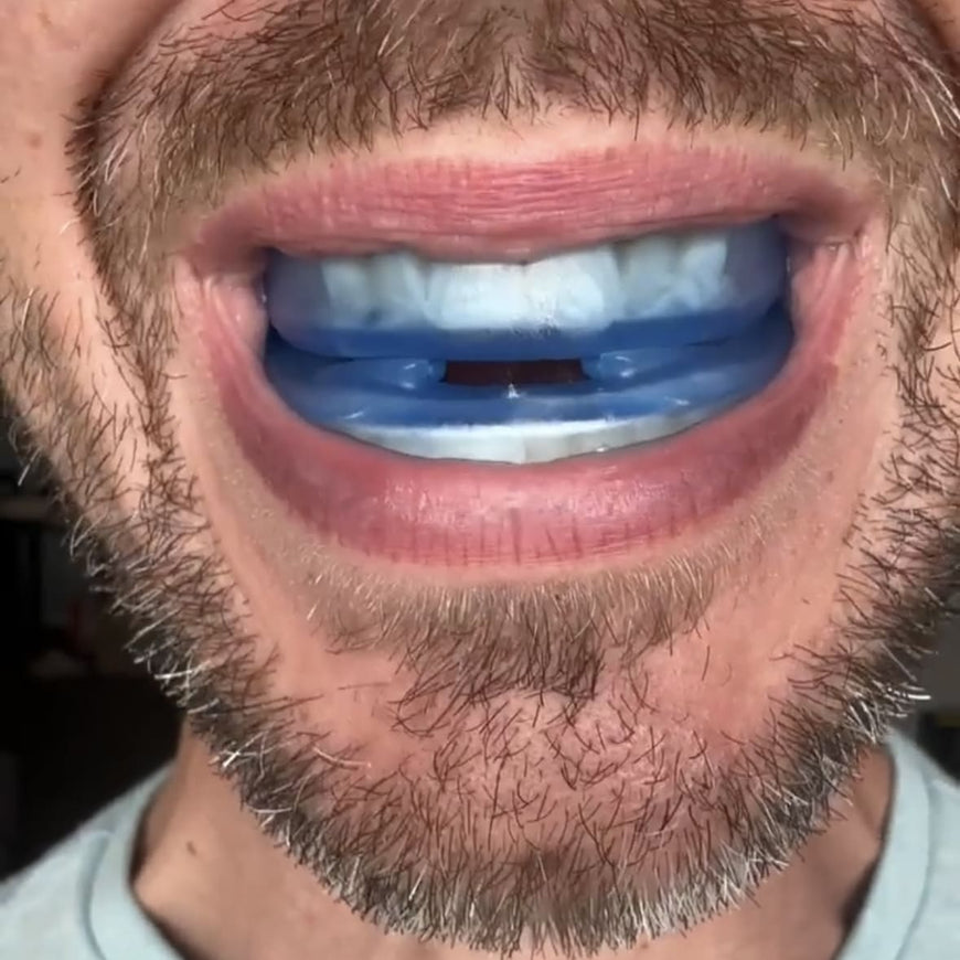 Anti-Snoring Mouthpiece | Adjustable Sleep Guard for Quieter Nights