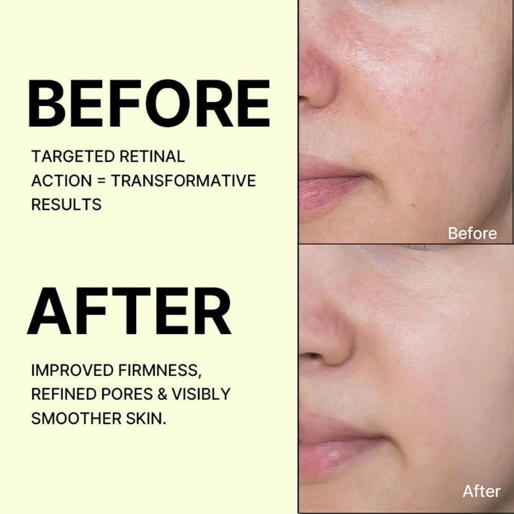 Seoul Retinal Vitamin C Hydrating Face Cream & Eye Serum