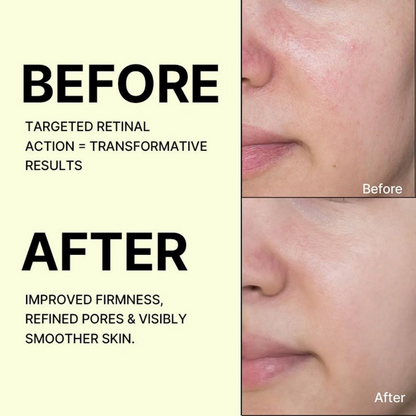 Seoul Retinal Vitamin C Hydrating Face Cream & Eye Serum