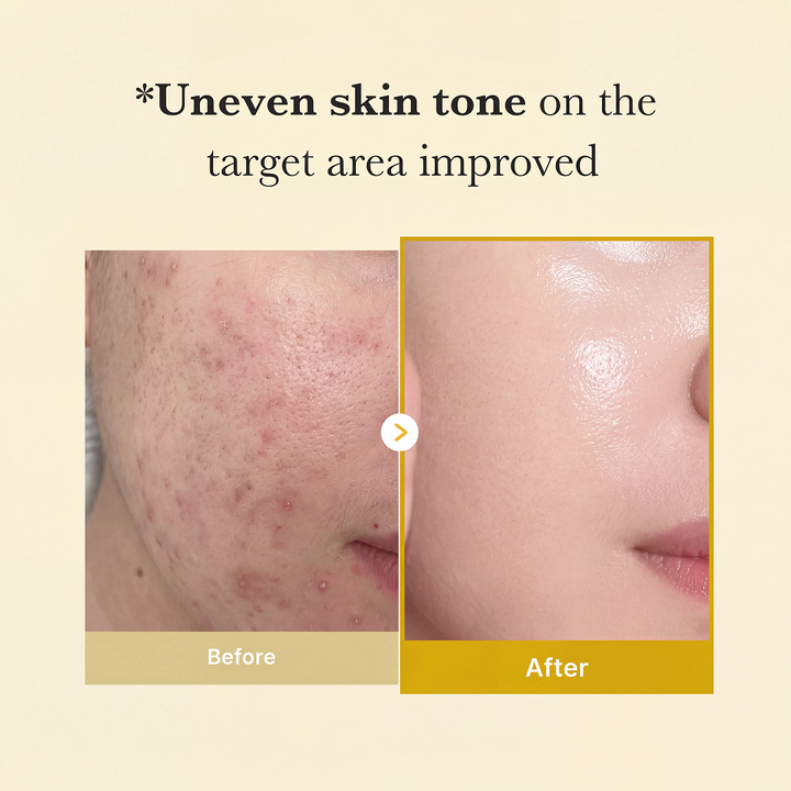 Zenverra™ Overnight Glow Wrapping Mask
