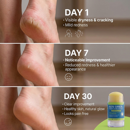 PureFoot 60% Urea Foot Repair Stick for Dry & Cracked Heels